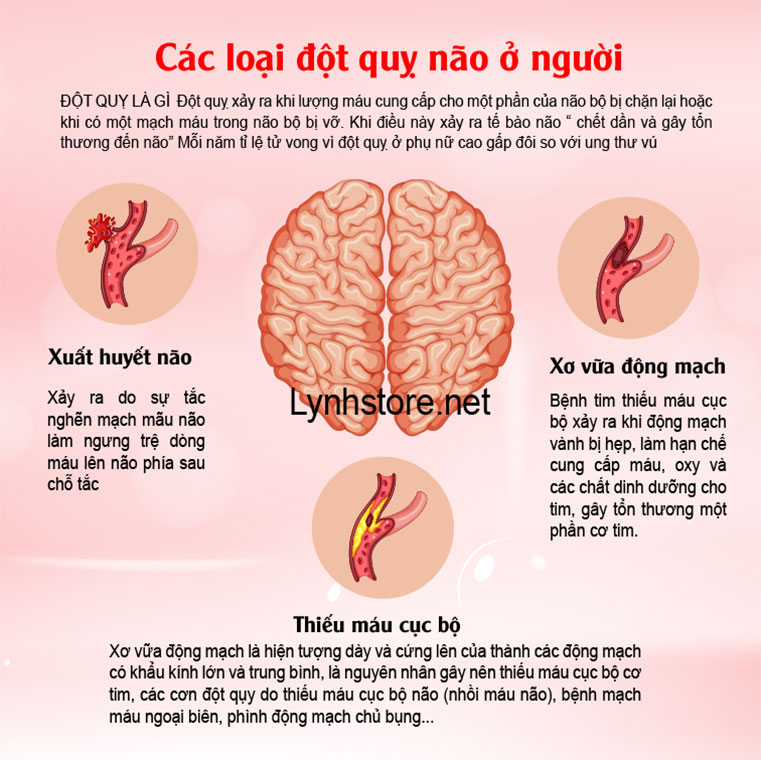 Viên uống hỗ trợ điều trị tai biến Nattokinase 2000FU Orihiro Nhật
