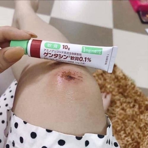 Kem trị sẹo Gentacin Nhật Bản tuýp 10g